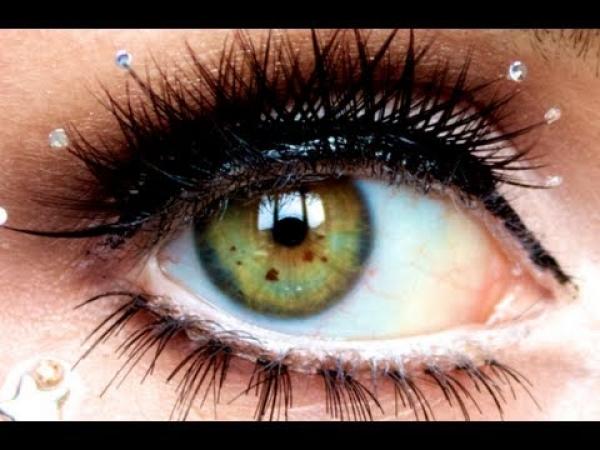 Φακίδες των ματιών, Τα σκοτεινά σημεία στην ίριδα μπορεί να προκληθούν από έκθεση στον ήλιο